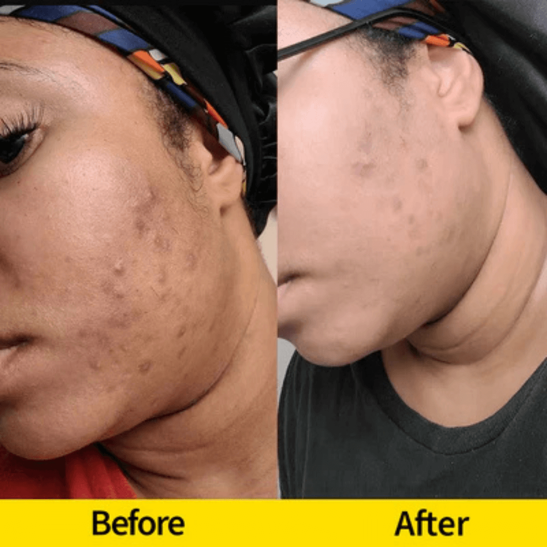Turmeric & Kojic Acid Brightening Foaming Cleanser β Deep Pore Cleanser for Glowing Skin | Gentle Daily Face Wash - Honey Glow