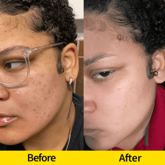 Glow Up with Lemon Turmeric Kojic Acid Soap: - Honey Glow