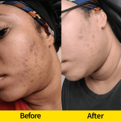 Turmeric & Kojic Acid Brightening Foaming Cleanser – Deep Pore Cleanser for Glowing Skin | Gentle Daily Face Wash - Honey Glow
